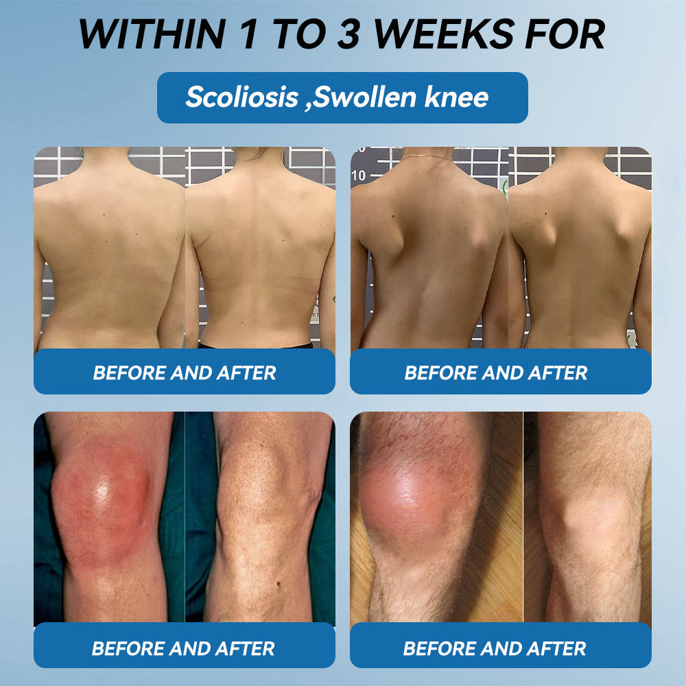 𝖯𝗂𝖼𝗱𝗼® BPC-157 Joint Healing Cream👩⚕️Treats Arthritis, Neuropathy, Rheumatism, Sports Injuries & More👍