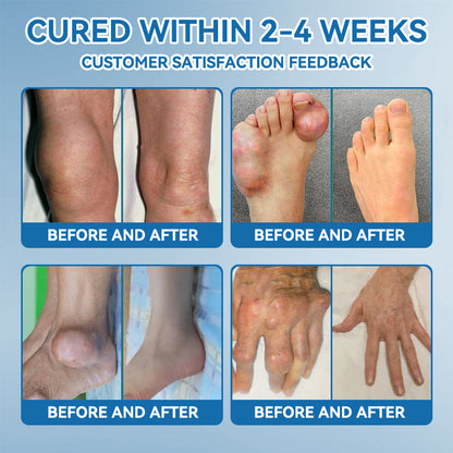 𝖯𝗂𝖼𝗱𝗼® BPC-157 Joint Healing Cream👩‍⚕️Treats Arthritis, Neuropathy, Rheumatism, Sports Injuries & More👍