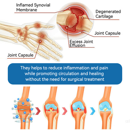 𝖯𝗂𝖼𝗱𝗼® BPC-157 Joint Healing Cream👩‍⚕️Treats Arthritis, Neuropathy, Rheumatism, Sports Injuries & More👍