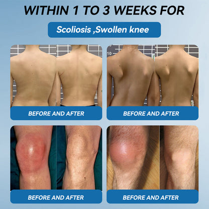 𝖯𝗂𝖼𝗱𝗼® BPC-157 Joint Healing Cream👩‍⚕️Treats Arthritis, Neuropathy, Rheumatism, Sports Injuries & More👍