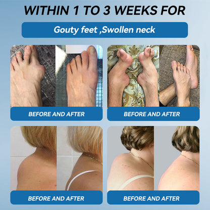 𝖯𝗂𝖼𝗱𝗼® BPC-157 Joint Healing Cream👩‍⚕️Treats Arthritis, Neuropathy, Rheumatism, Sports Injuries & More👍